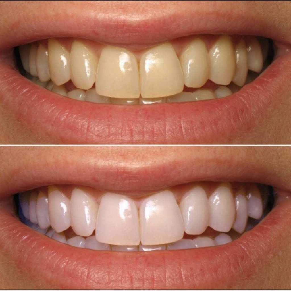 BOT TAY TRANG RANG EUCRYL TOOTHPOWDER -50G