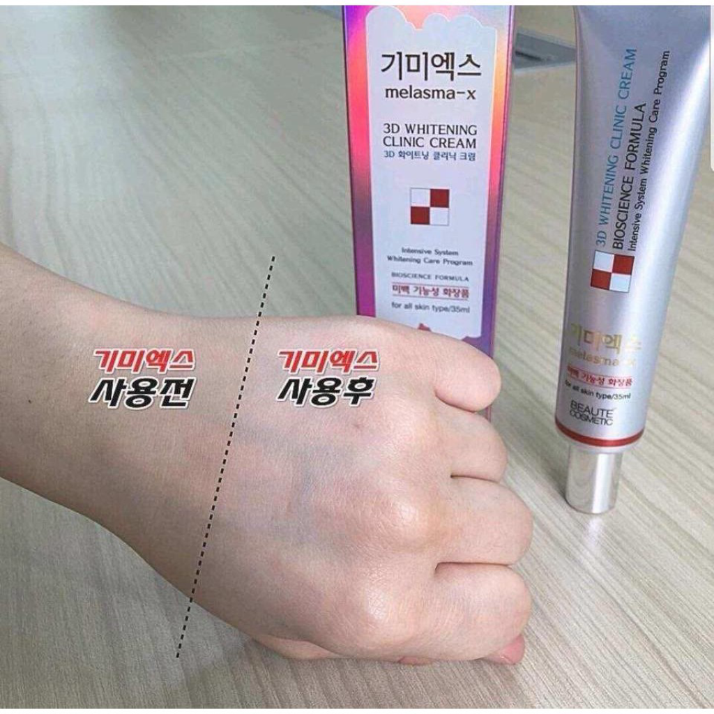 KEM LAM MO THAM NAM VA TAN NHANG MELASMA-X 3D WHITENING CLINIC CREAM 35ML HANG CHINH HANG